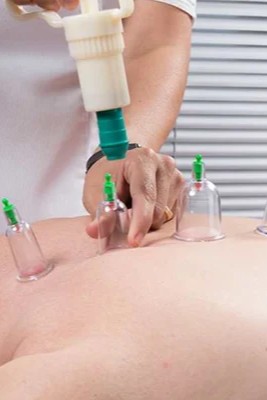 الحجامة العلاجية