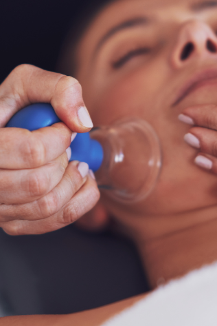 الحجامة التجميلية